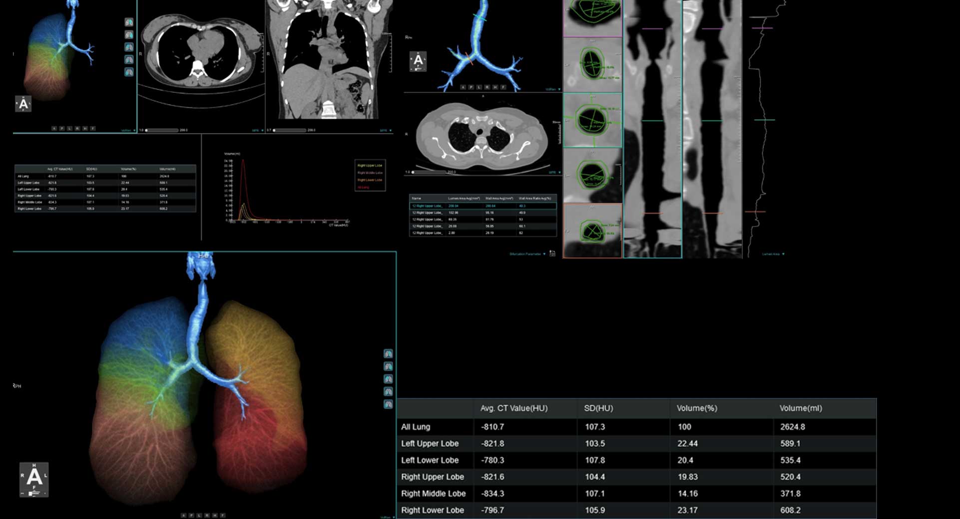 Lung-Density-